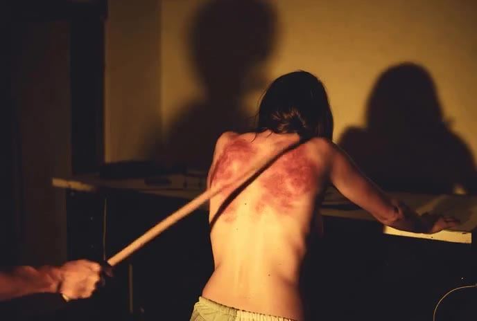 severe caning back